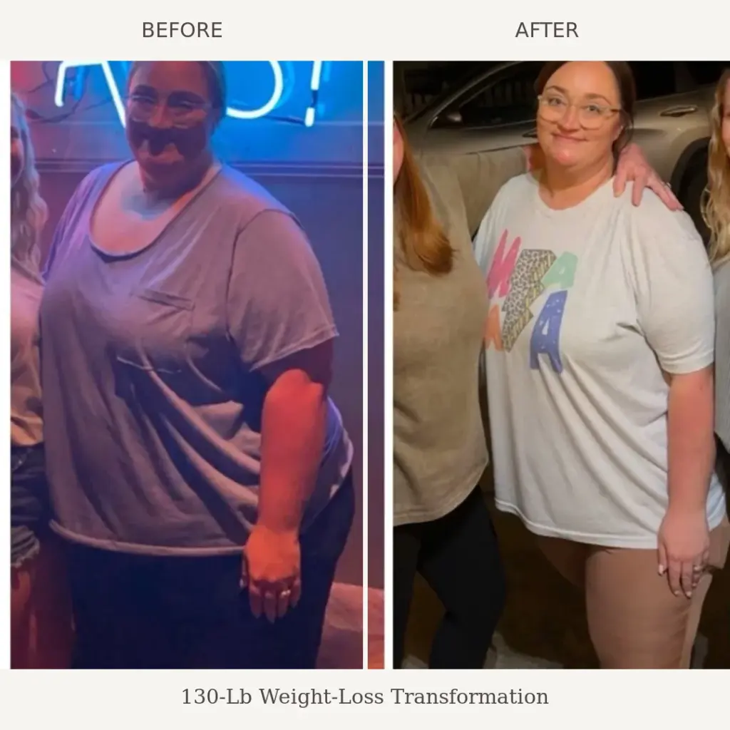 Side by side before and after photos of a woman in glasses showing a 130 pound weight loss.